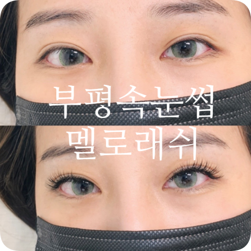 멜로래쉬 이미지