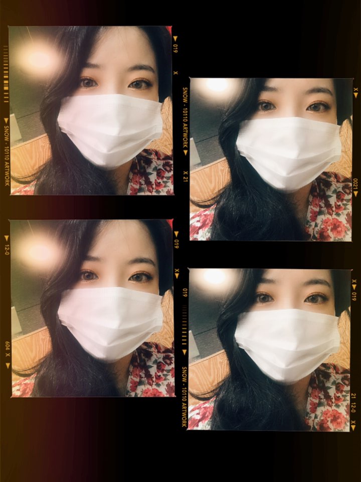 태풍반점 이미지
