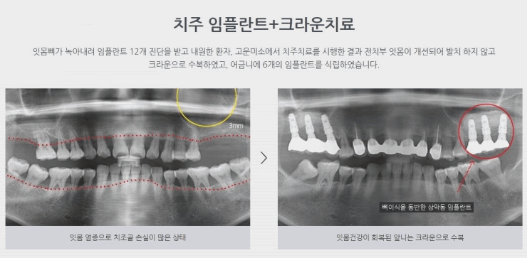 연세고운미소치과의원 이미지