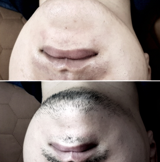 왁싱피플 이미지