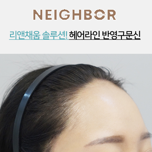 헤어라인 이미지