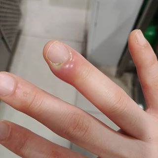 수지네일 이미지
