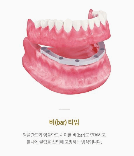 서울위치과의원 이미지