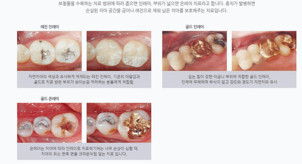 연세본치과의원 이미지