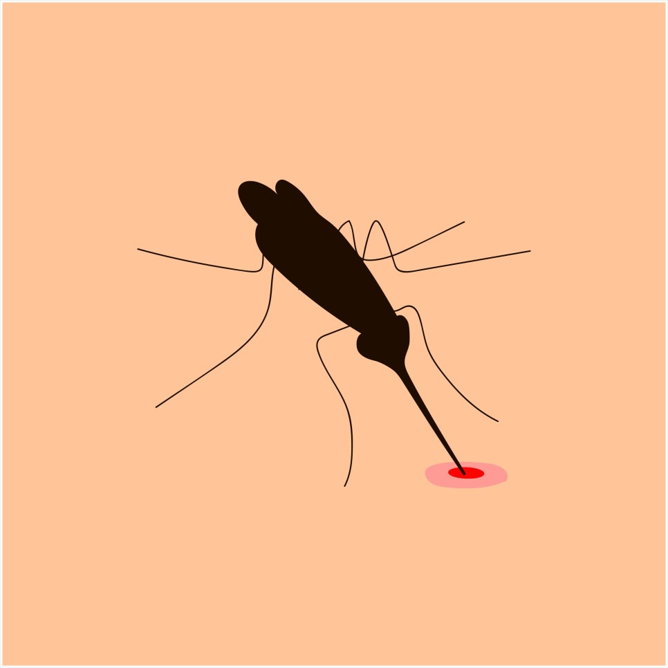 모기아트 이미지