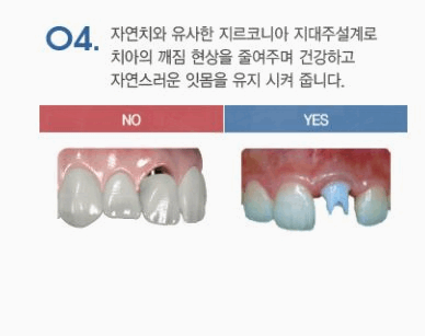 바른사람치과 이미지