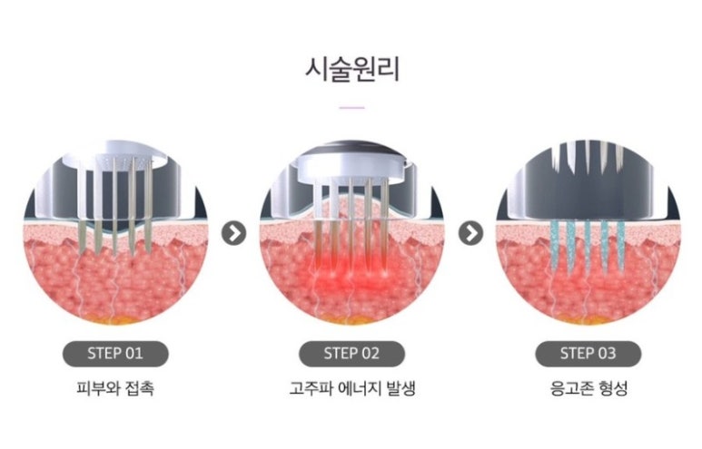미켈란에이치의원 이미지