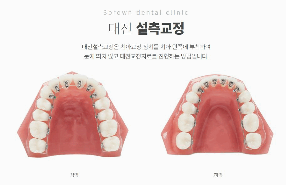 서울브라운치과 이미지