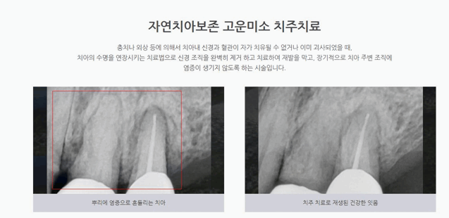 연세플러스치과 이미지