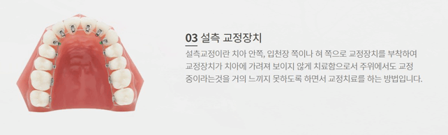 서울브라운치과 이미지