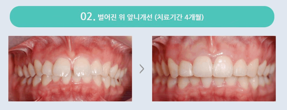 연세고운미소치과의원 이미지