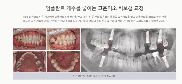 삼성서울치과의원 이미지