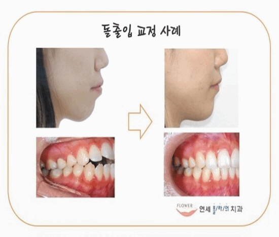 연세플라워치과의원 이미지