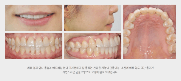 연세미소치과의원 이미지