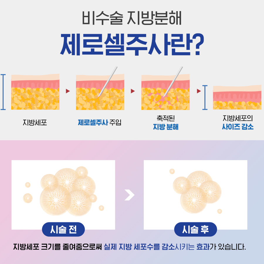 비엘에스의원 이미지