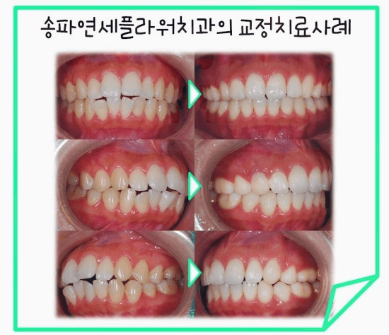 연세바로치과의원 이미지