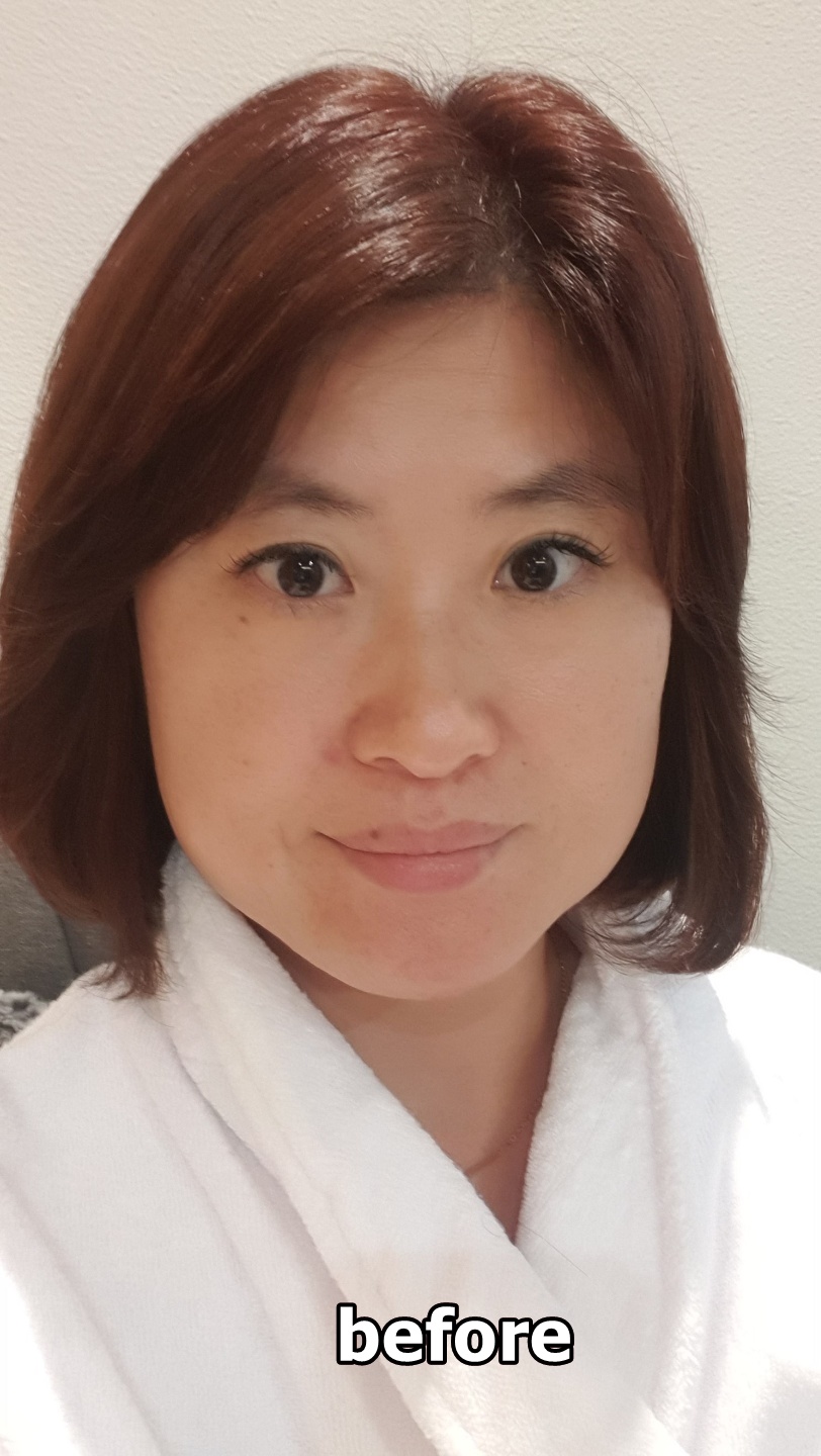 테라피미애美愛 이미지