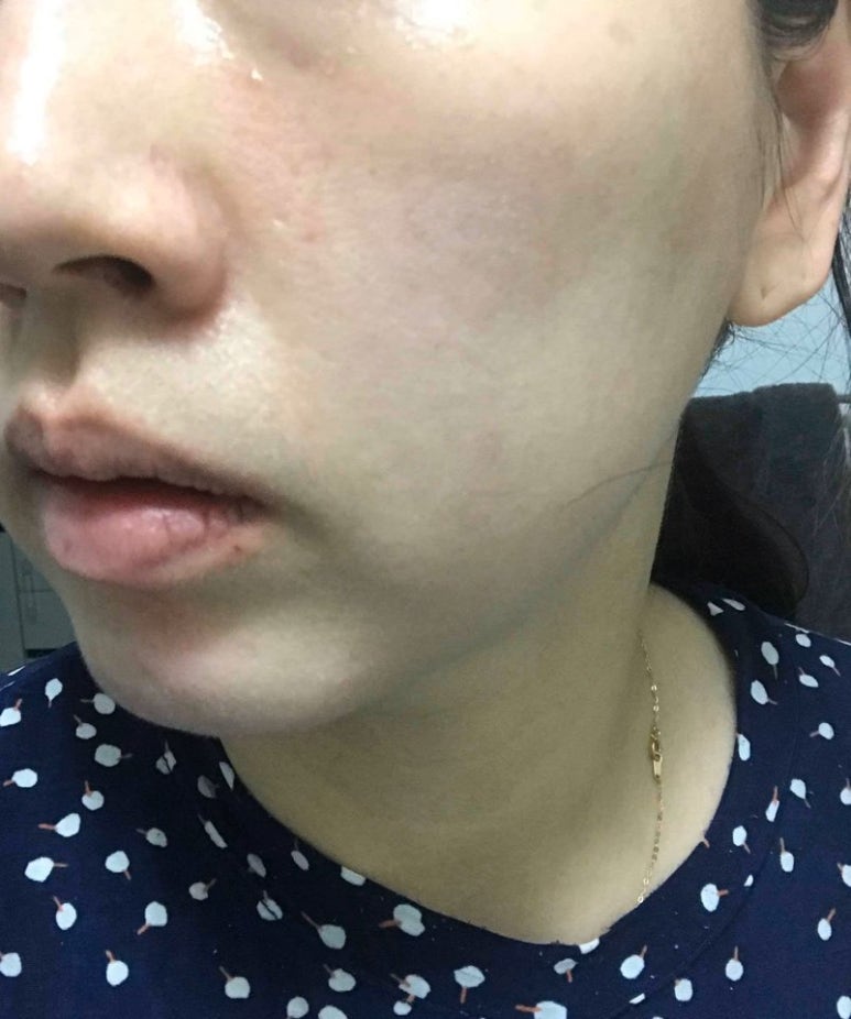 이오스타 이미지