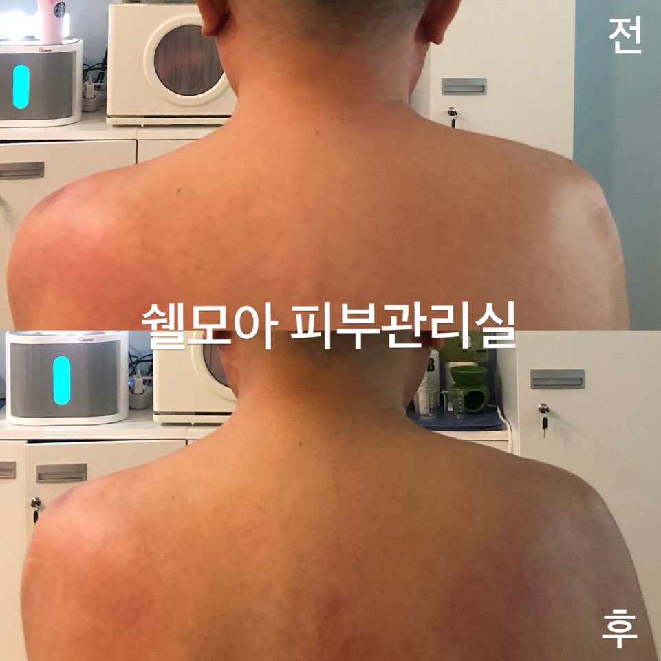 쉘모아 이미지