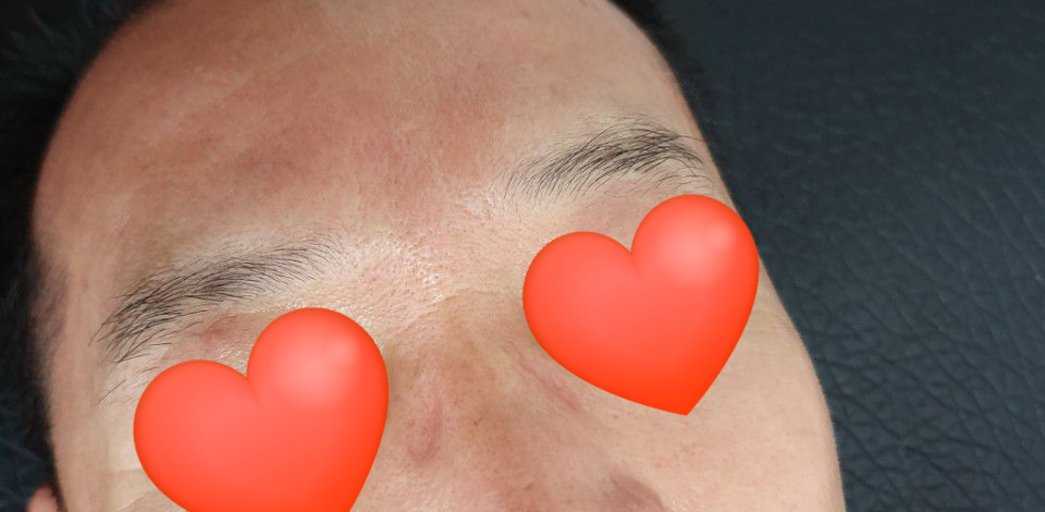 잔나비네일 이미지
