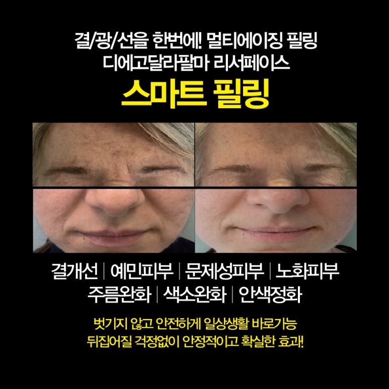 스마트필 이미지