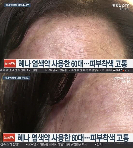 염색팡팡 이미지