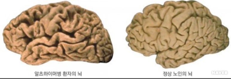 휴두피n뷰티센터 이미지