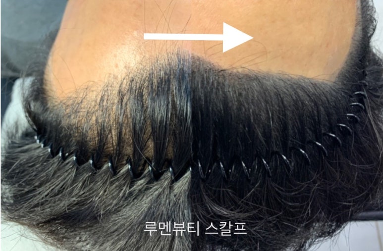 루멘헤어 이미지