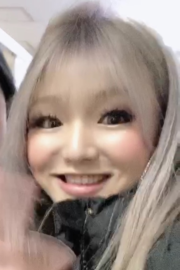 모자이크성형외과의원 이미지