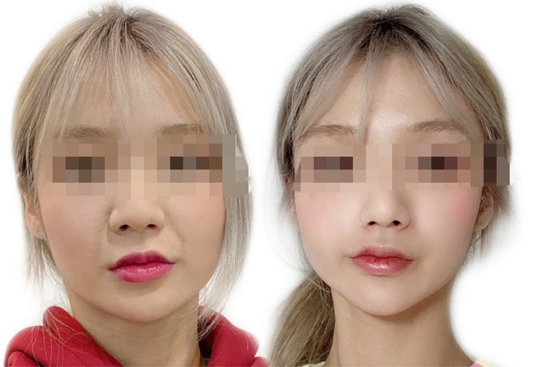 모자이크성형외과의원 이미지