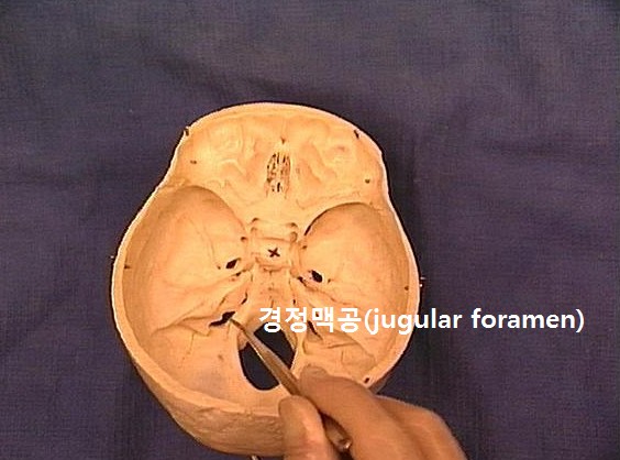굿체형관리 이미지