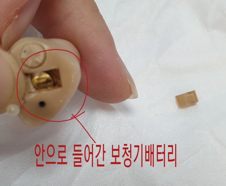 메디컬 보청기 이미지