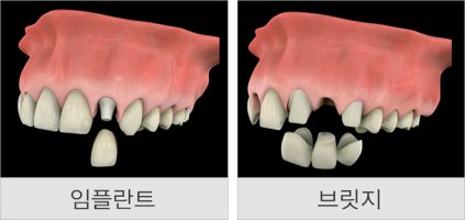 민치과 이미지