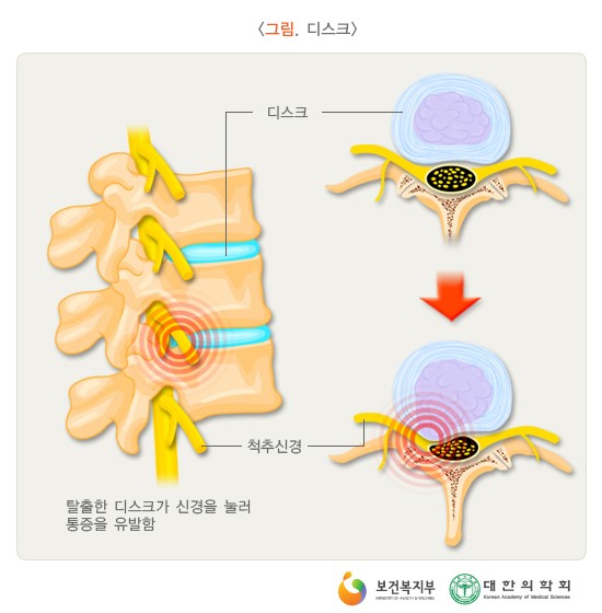 더디스크 이미지