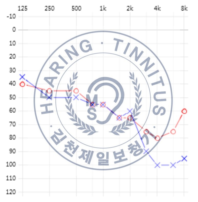 메디컬 보청기 이미지