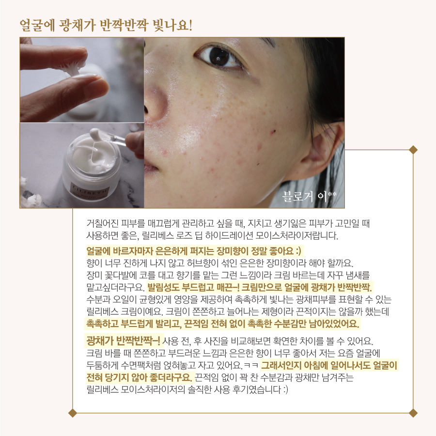베스하이 이미지
