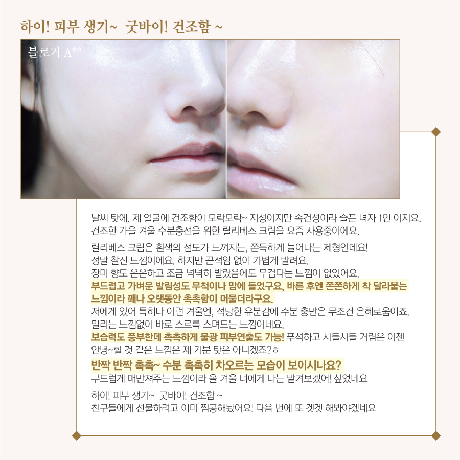 베스하이 이미지