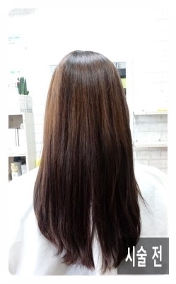 미가헤어라인 이미지