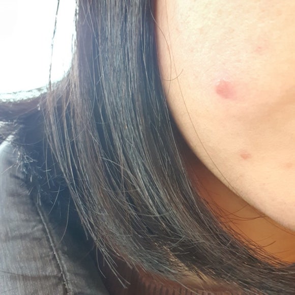 조이피부과의원 이미지