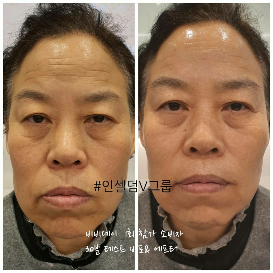 비비시스템 이미지