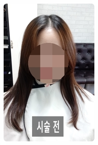 미가헤어라인 이미지