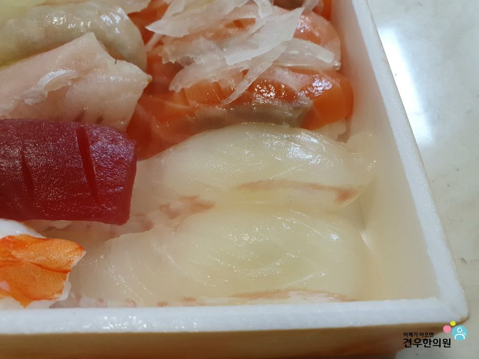 킹스시 이미지