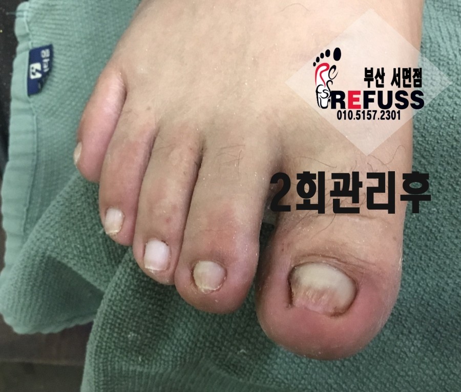 미몽 이미지