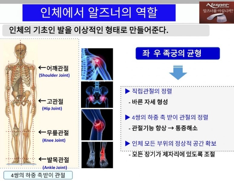 알즈너대한 이미지