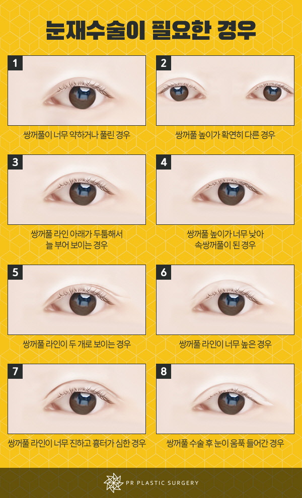 고려피알 이미지