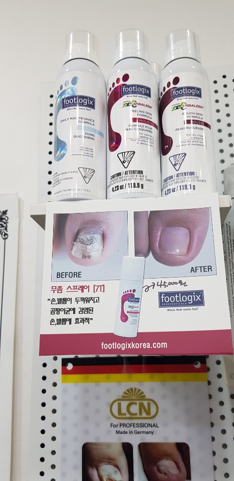 키스네일 이미지