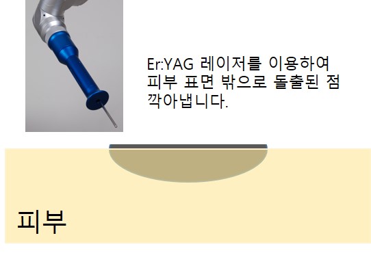 미소가인피부과의원 이미지