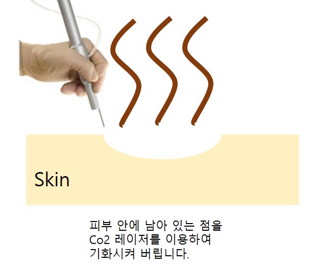 미소가인피부과의원 이미지
