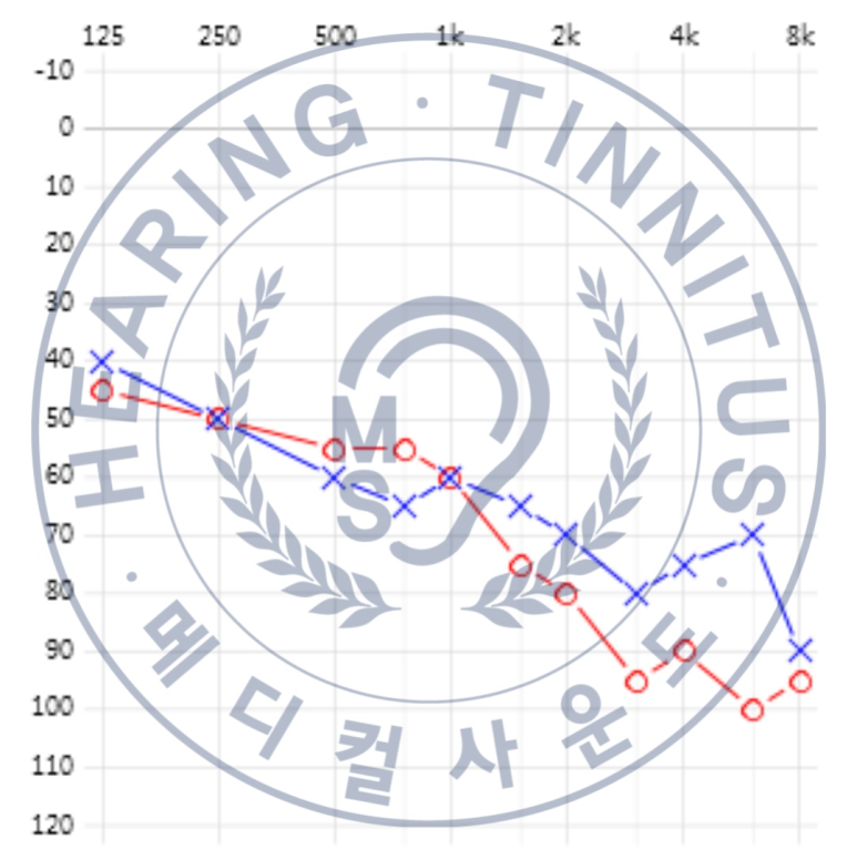 메디컬 보청기 이미지
