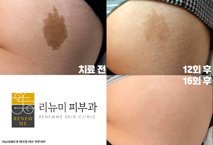 성일반점 이미지